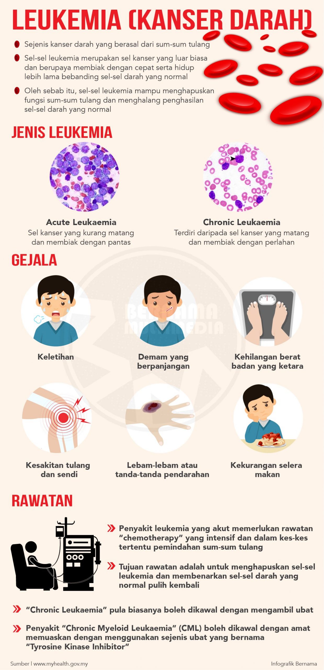 Penyakit Leukemia Punca, Tanda dan Rawatan Tips Kesihatan