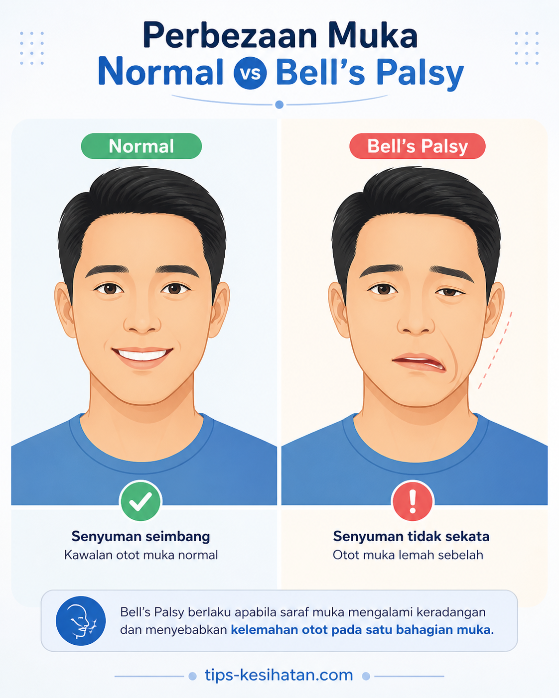 Penyakit Bell s Palsy Tanda Dan Punca Tips Kesihatan penyakit-bell-s-palsy-tanda-dan-punca-tips-kesihatan